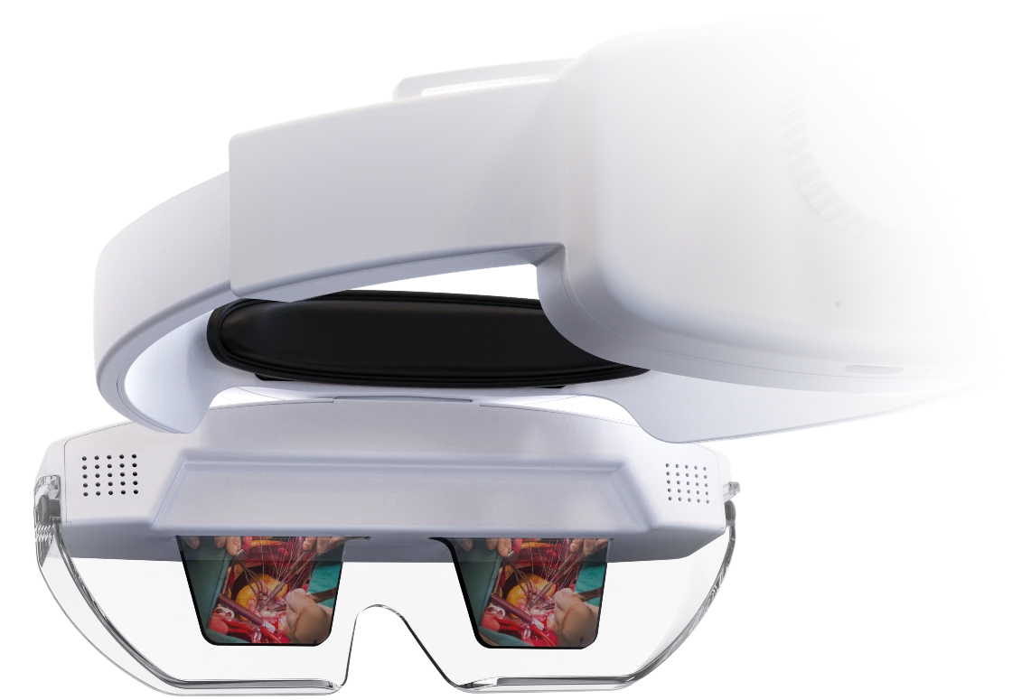 ARCviewer AR glasses display