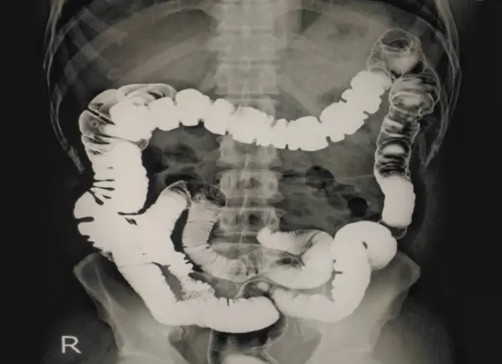 CT scan head imaging