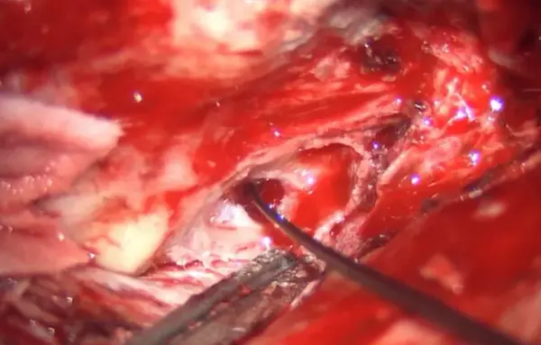 Endoscopy monitor display