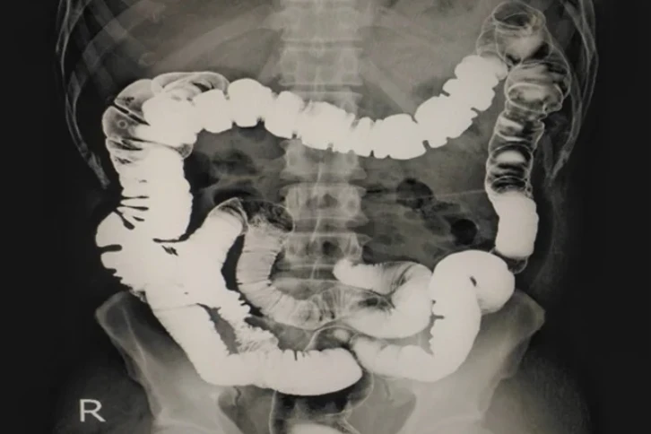 CT imaging for surgical planning