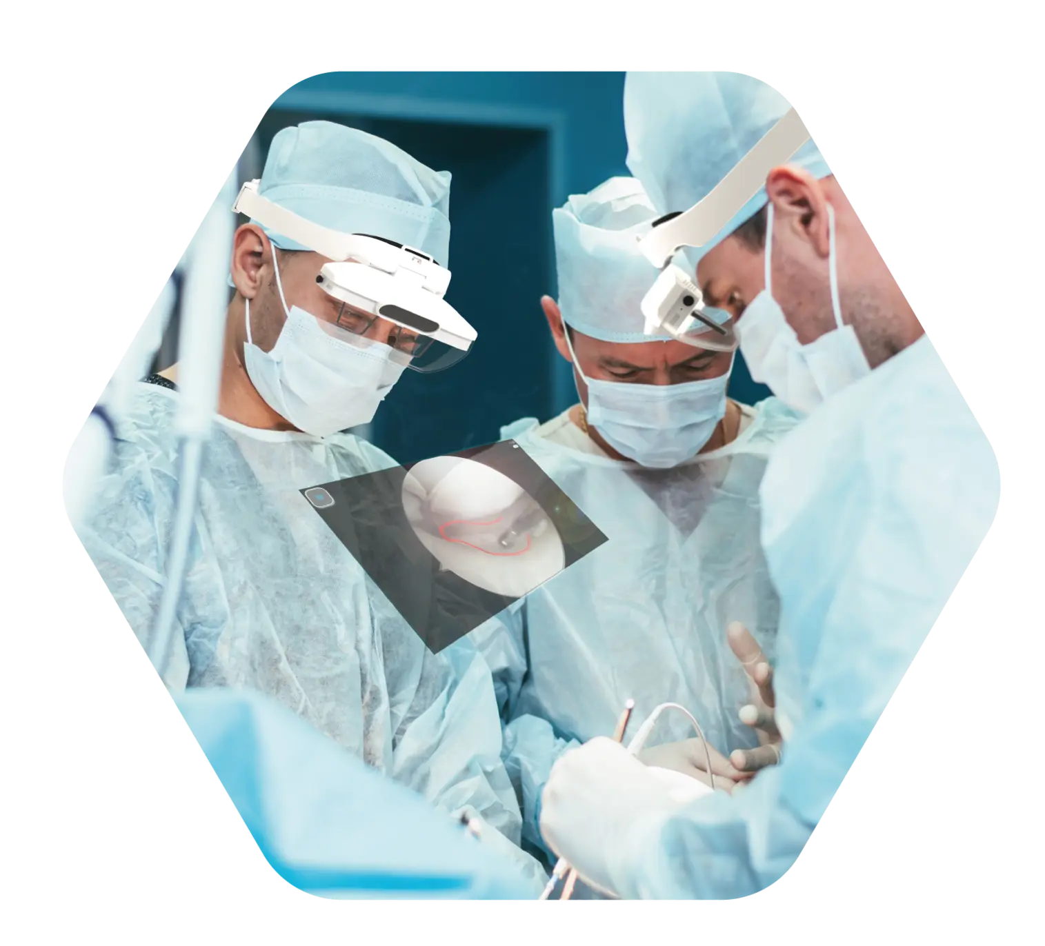 Surgeons with AR headsets
